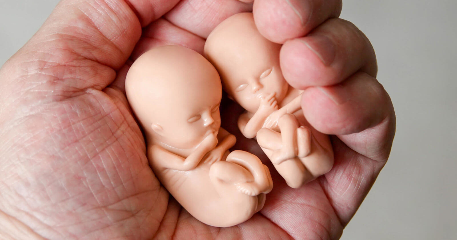 Almost 1 in 3 conceptions ended in abortion in England and Wales in 2022