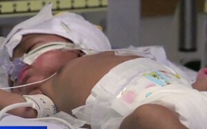 Born at 24 weeks weighing 1lb 9oz, baby Daveen is now thriving at home