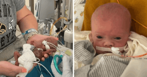 World's most premature baby celebrates first birthday