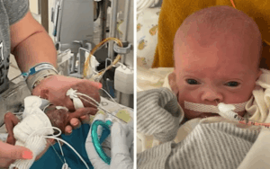 World’s most premature baby celebrates first birthday