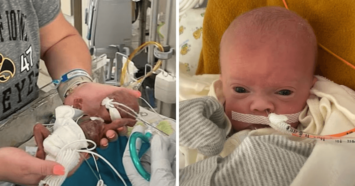 World's most premature baby celebrates first birthday