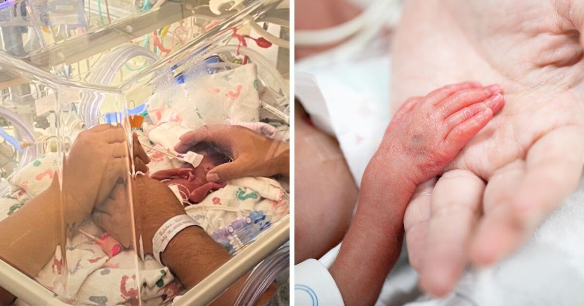 Premature baby born at only 22 weeks “a fighter” after almost five months in hospital