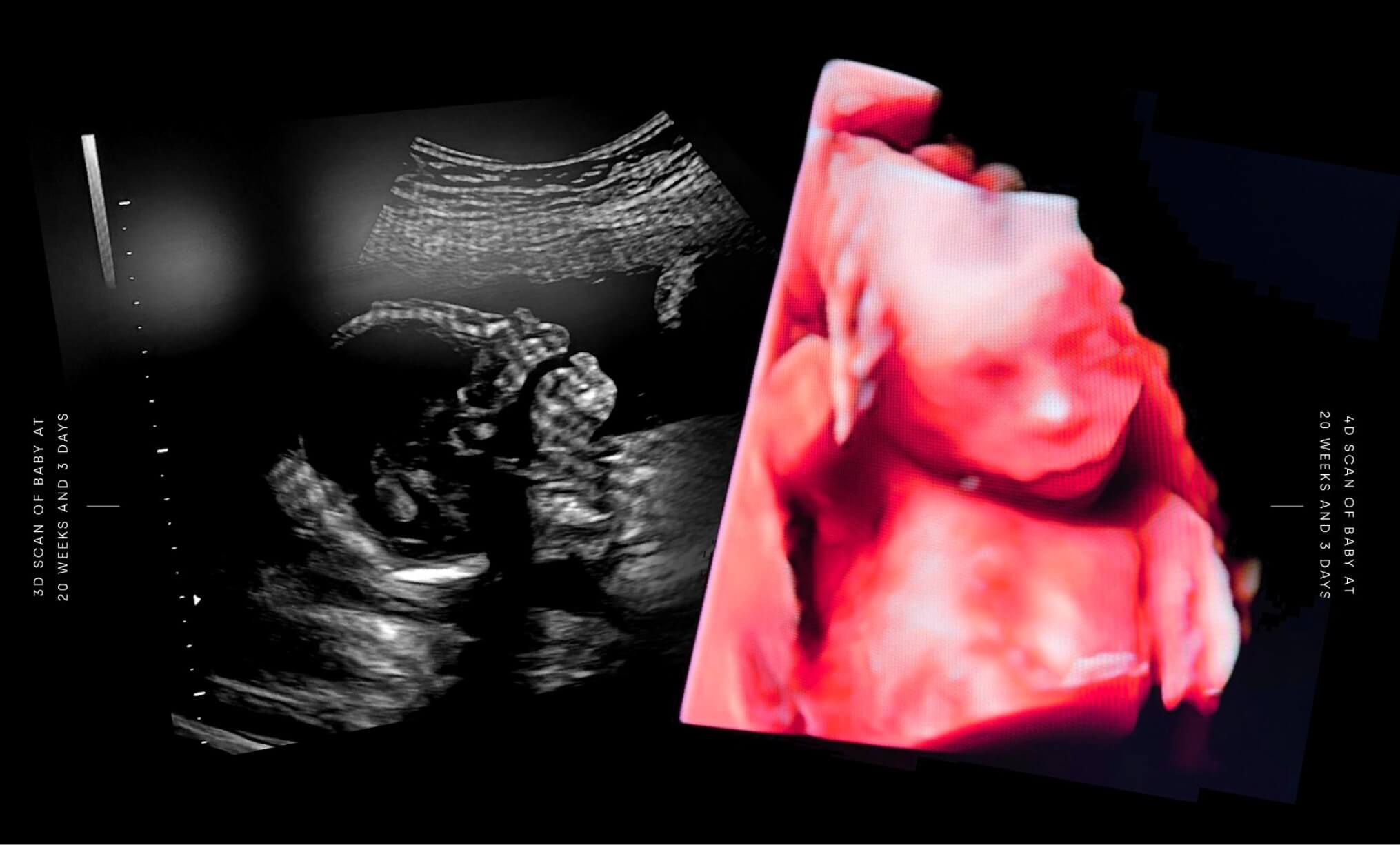 Reason 5 - Our increasing understanding of life before birth