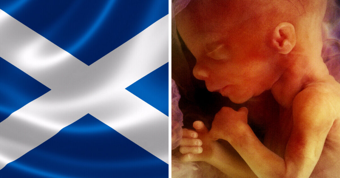Press release – Calls for Scottish Government to reject extreme abortion up to birth plans