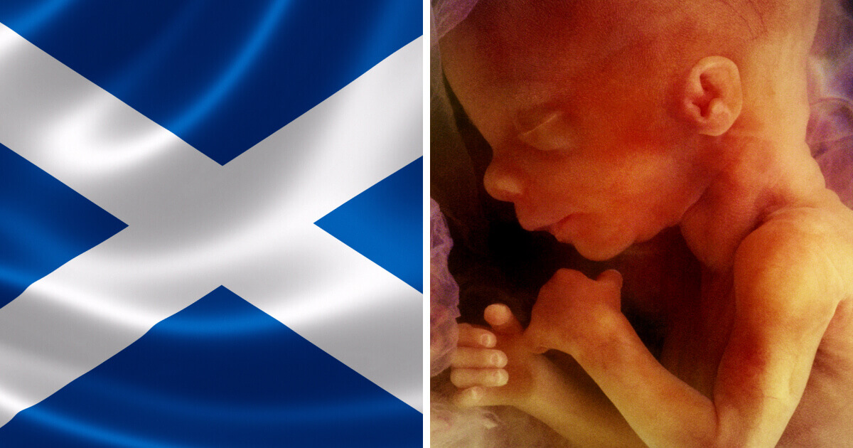 Press release – Calls for Scottish Government to reject extreme abortion up to birth plans Press release - Calls for Scottish Government to reject extreme abortion up to birth plans