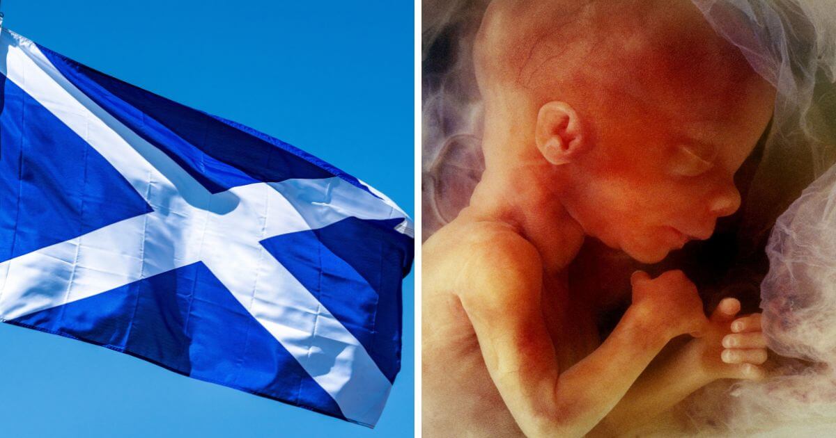 Calls for Scottish Government to reject extreme abortion up to birth plans Calls for Scottish Government to reject extreme abortion up to birth plans