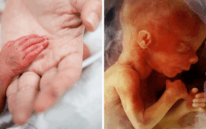 “Miracles do happen”: Premature baby born at 23 weeks and spending 230 days in hospital now home