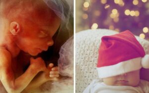Premature baby girl born one month early leaves the NICU just before Christmas