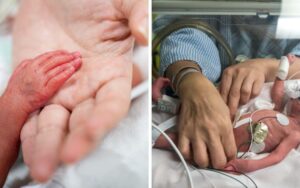 Premmie baby boy born at 23 weeks goes home after 230 days in hospital