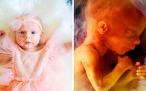 Evidence of 400 sex-selective abortions as Britain’s largest abortion provider claims practice not illegal