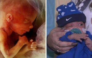 Premature baby born at only 25 weeks goes home after 120 days in hospital