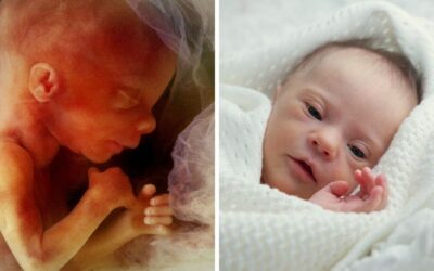 Number of babies with a disability aborted has increased, statistics reveal