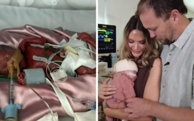 Australia’s most premature baby “thriving” after being born 4.5 months early