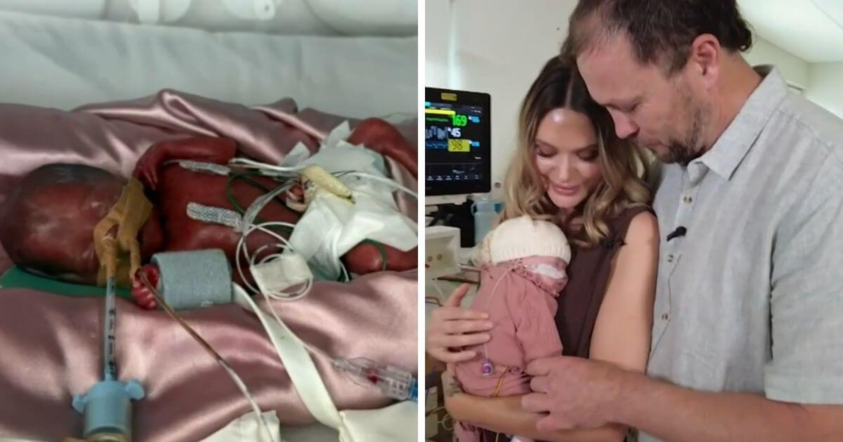 Australia’s most premature baby “thriving” after being born 4.5 months early