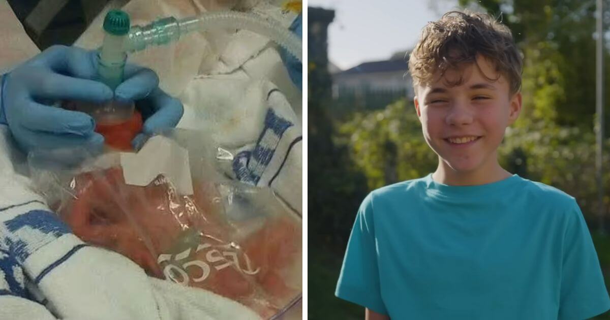 Premature baby born 13 weeks early and put in Tesco sandwich bag now “thriving”