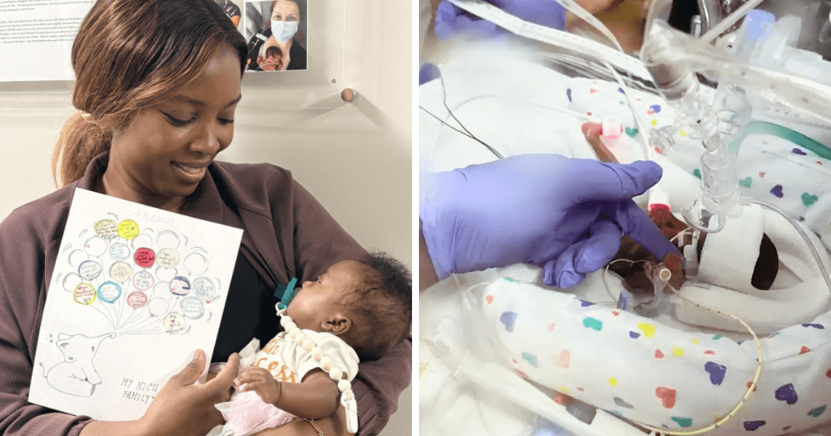 5,000 miles from home, premmie leaves hospital after 172 days 5,000 miles from home, premmie leaves hospital after 172 days