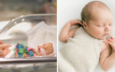Baby girl born at 22 weeks on World Prematurity Day defies odds as youngest surviving baby at UAE hospital