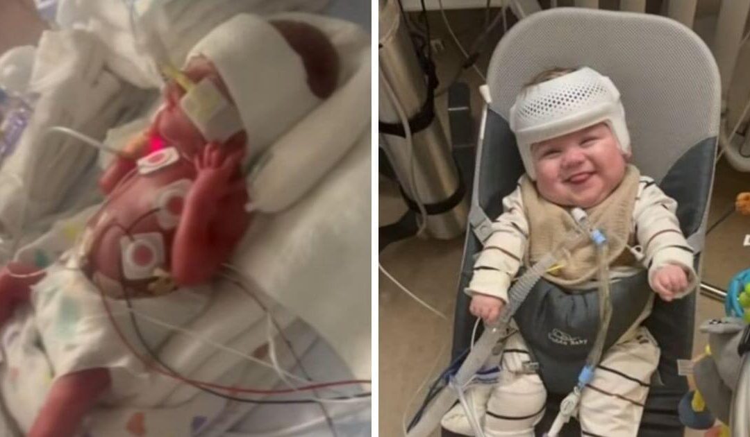 Premature baby boy finally ready to leave hospital over 400 days after birth
