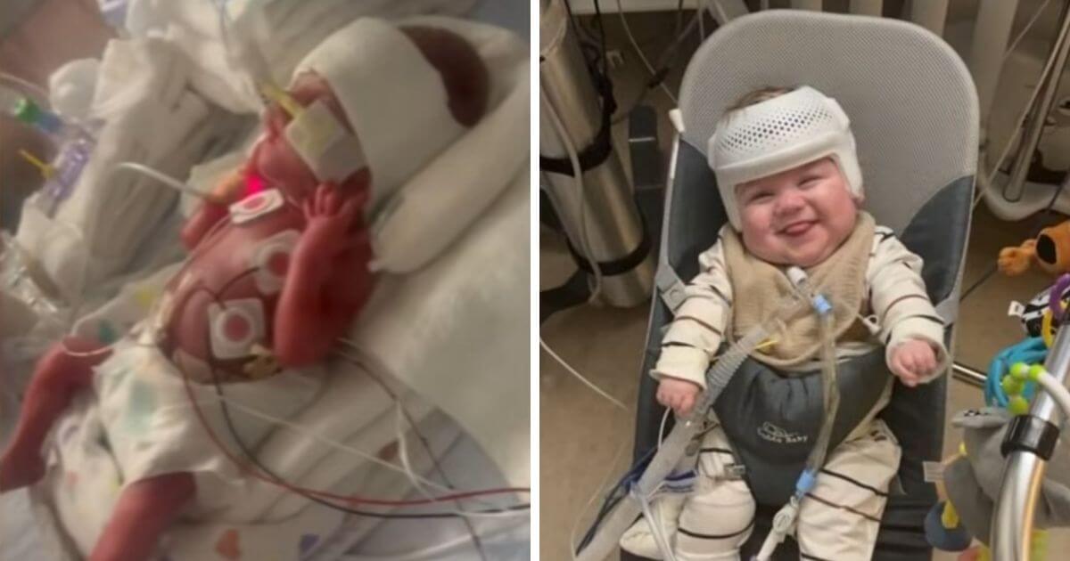 Premature Baby Who Only Weighed 24 Ounces Heads Home From Hospital