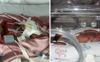 Tiny premature baby born with only 36ml of blood now thriving at 23 years old