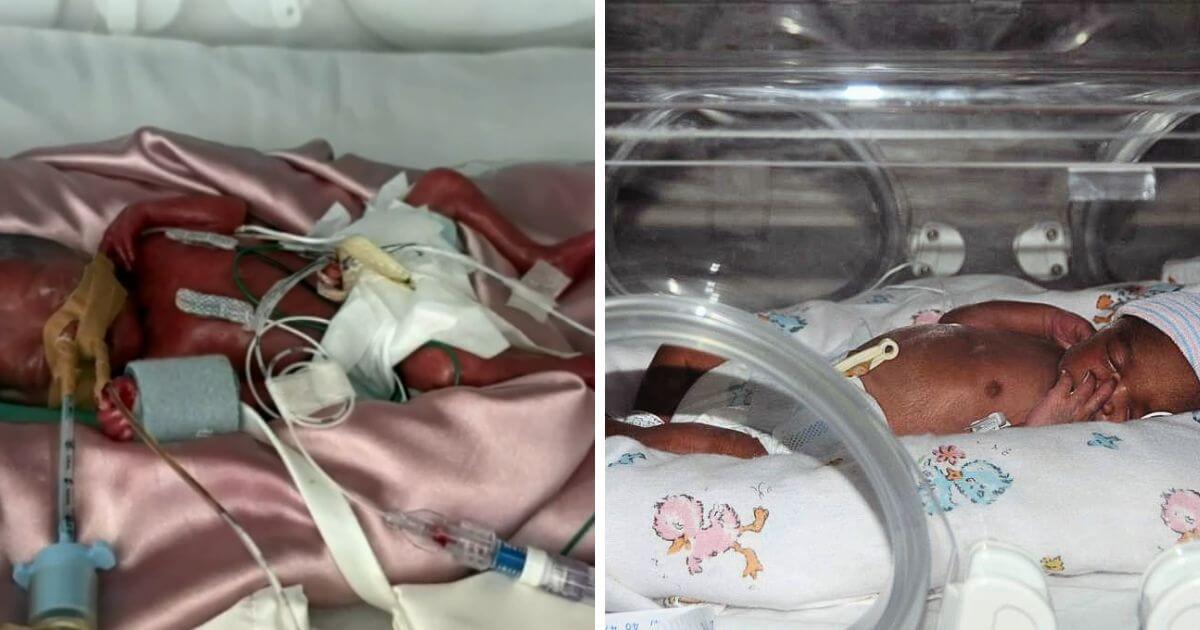 Tiny premature baby born with only 36ml of blood now thriving at 23 years old Tiny premature baby born with only 36ml of blood now thriving at 23 years old