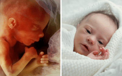 YouTuber faces intense criticism for choosing to abort child with Down’s syndrome