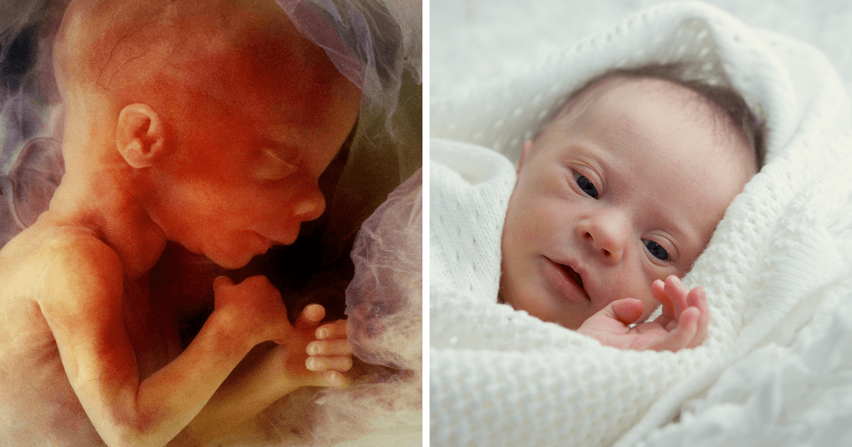 YouTuber-faces-intense-criticism-for-choosing-to-abort-child-with-Downs-syndrome