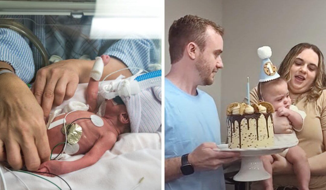 ‘Miracle baby’ born at just 22 weeks and weighing 1lb 4oz celebrates first birthday