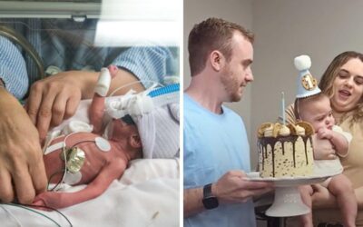 ‘Miracle baby’ born at just 22 weeks and weighing 1lb 4oz celebrates first birthday