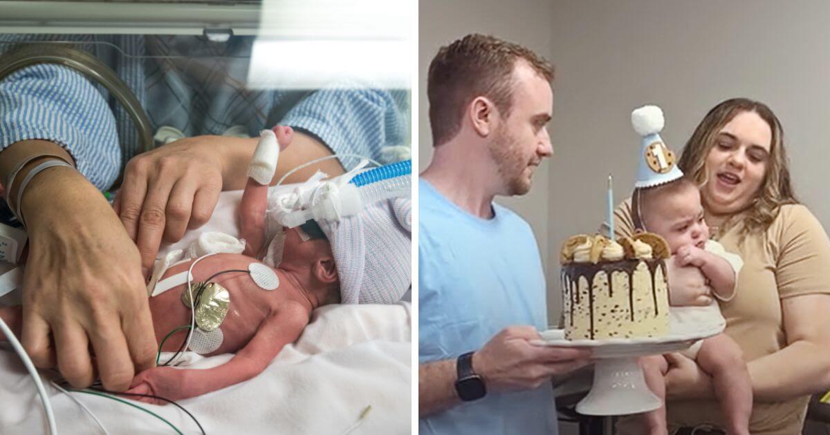 ‘Miracle baby’ born at just 22 weeks and weighing 1lb 4oz celebrates first birthday