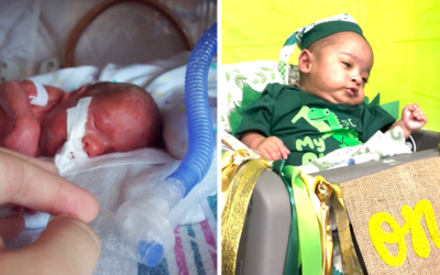 Baby born at 22 weeks and given 10% chance of survival celebrates first birthday
