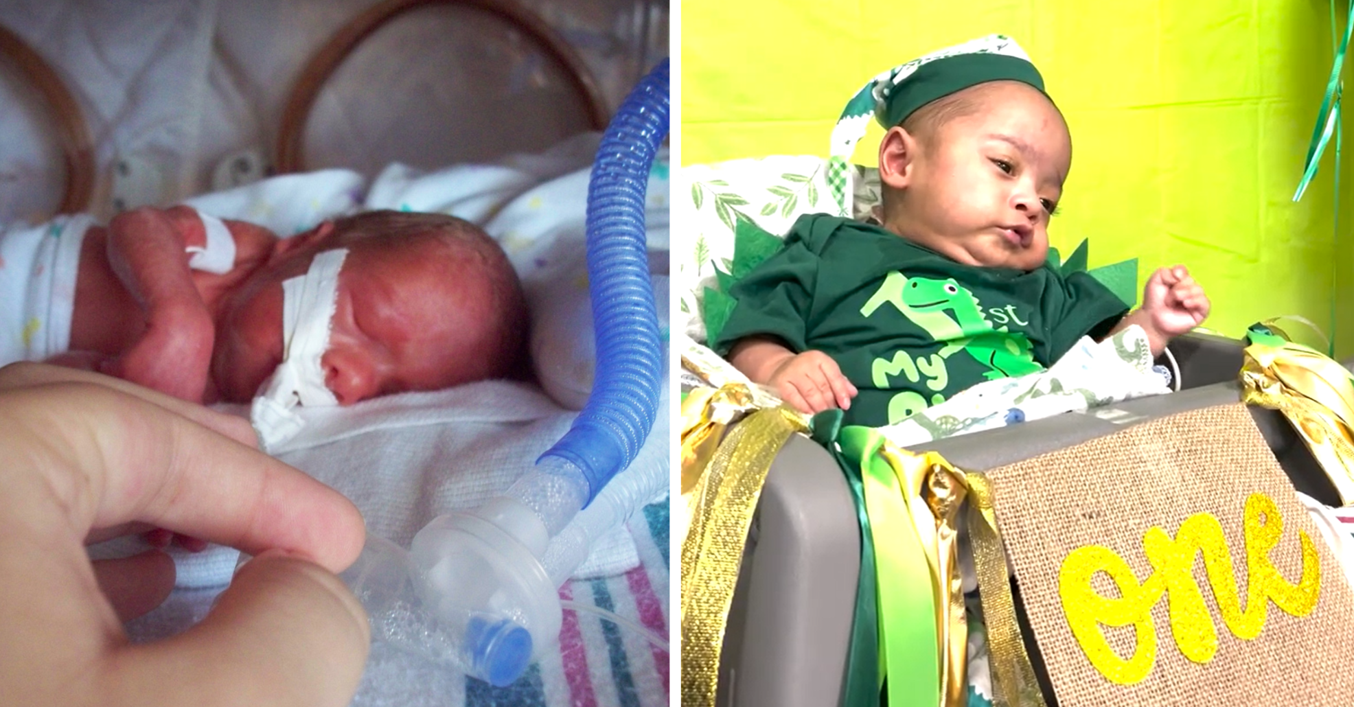 Baby-born-at-22-weeks-and-given-10%-chance-of-survival-celebrates-first-birthday Baby-born-at-22-weeks-and-given-10%-chance-of-survival-celebrates-first-birthday.png