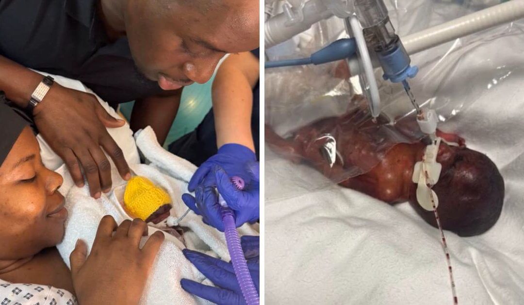 Baby born at just 22 weeks and weighing 555 grams is ‘thriving’ as doctors prepare for him to leave hospital