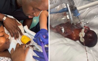 Baby born at just 22 weeks and weighing 555 grams is ‘thriving’ as doctors prepare for him to leave hospital