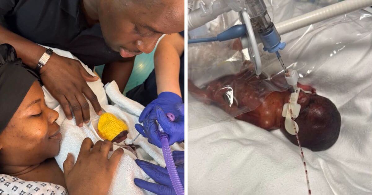 Baby born at just 22 weeks and weighing 555 grams is ‘thriving’ as doctors prepare for him to leave hospital