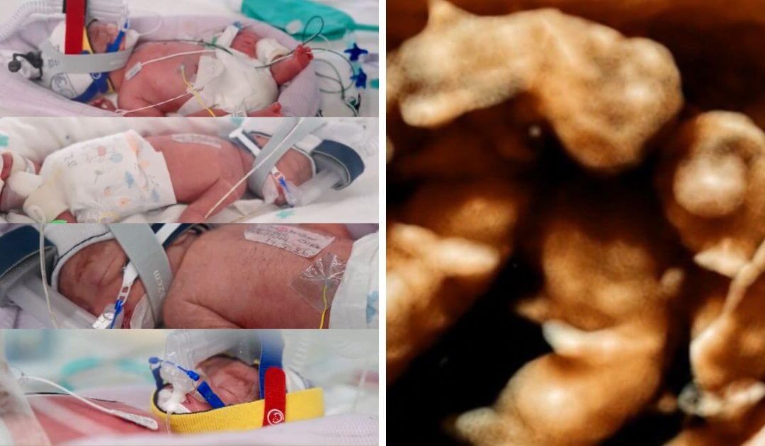 Identical quadruplet baby girls born at 28 weeks doing “extremely well” after exceptionally rare pregnancy