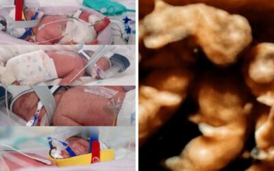 Identical quadruplet baby girls born at 28 weeks doing “extremely well” after exceptionally rare pregnancy