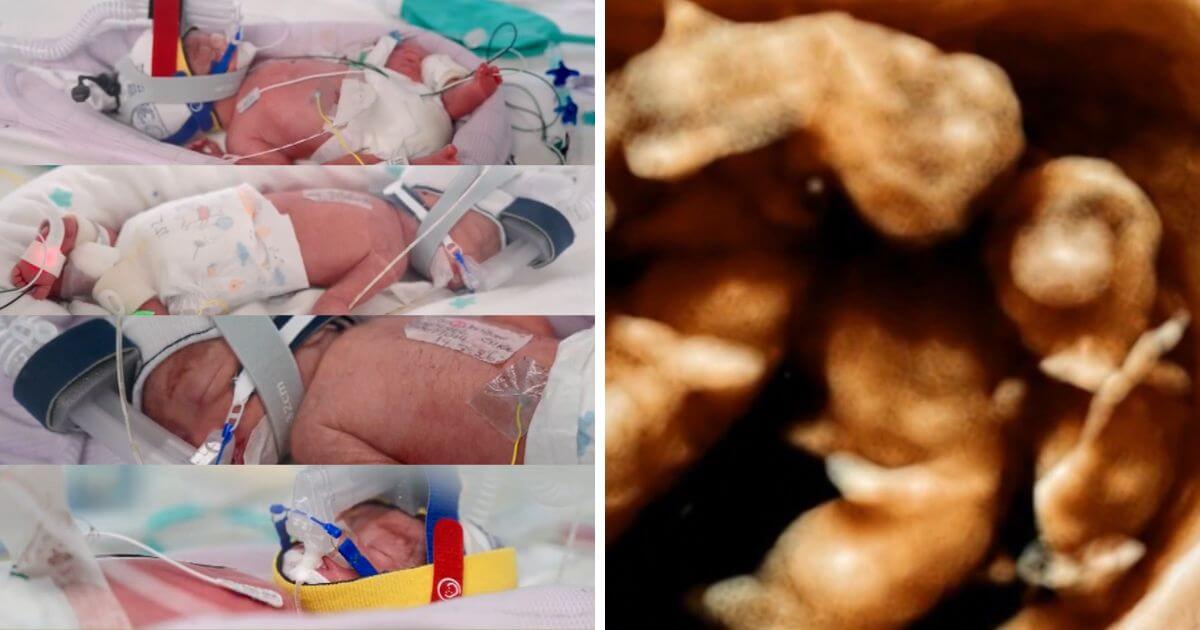 Identical quadruplet baby girls born at 28 weeks doing “extremely well” after exceptionally rare pregnancy
