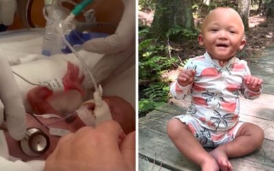 Micropremmie born at 23 weeks graduates from hospital after six-month fight for survival