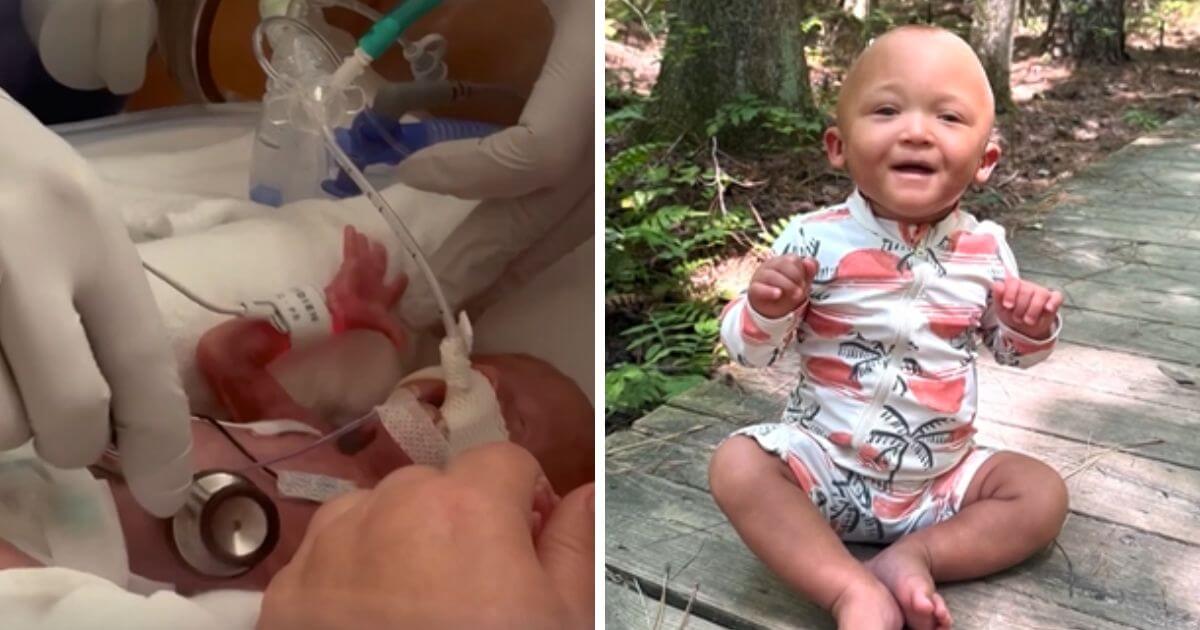 Micropremmie born at 23 weeks graduates from hospital after six-month fight for survival