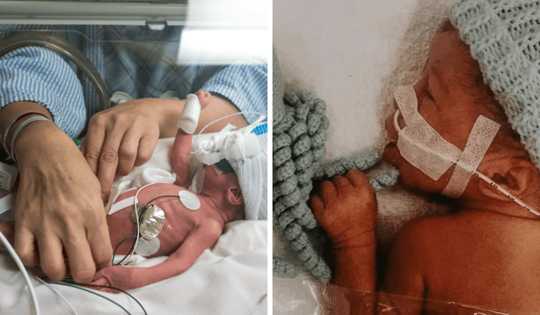 Tiny baby boy born at only 25 weeks gets stronger every day