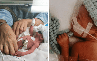 Tiny baby boy born at only 25 weeks gets stronger every day
