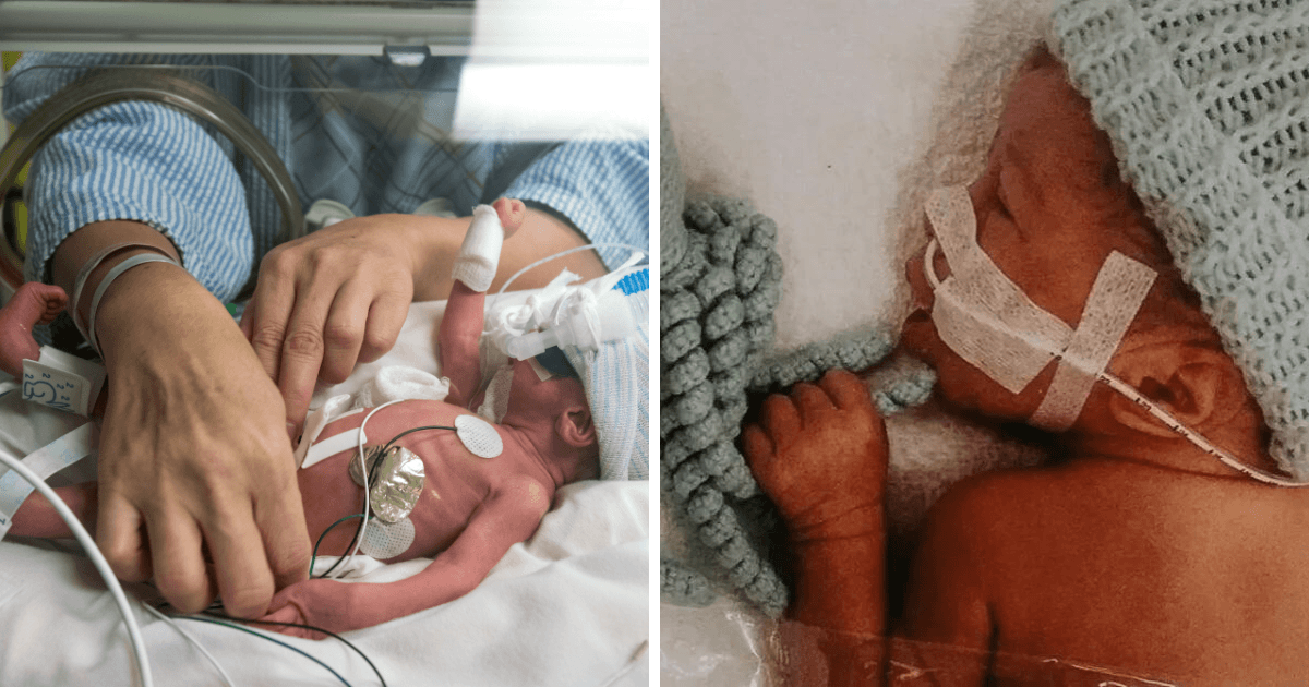tiny-baby-boy-born-at-only-25-weeks-gets-stronger-every-day tiny-baby-boy-born-at-only-25-weeks-gets-stronger-every-day