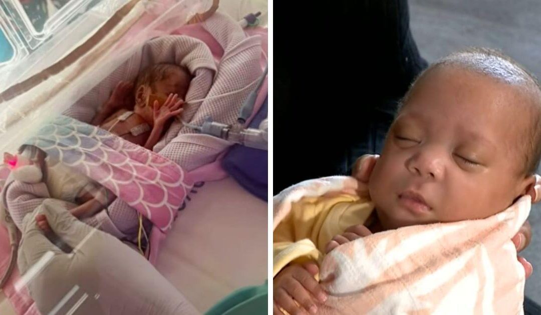 Australia’s most premature baby ever born at only 21 weeks 3 days