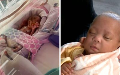 Australia’s most premature baby ever born at only 21 weeks 3 days