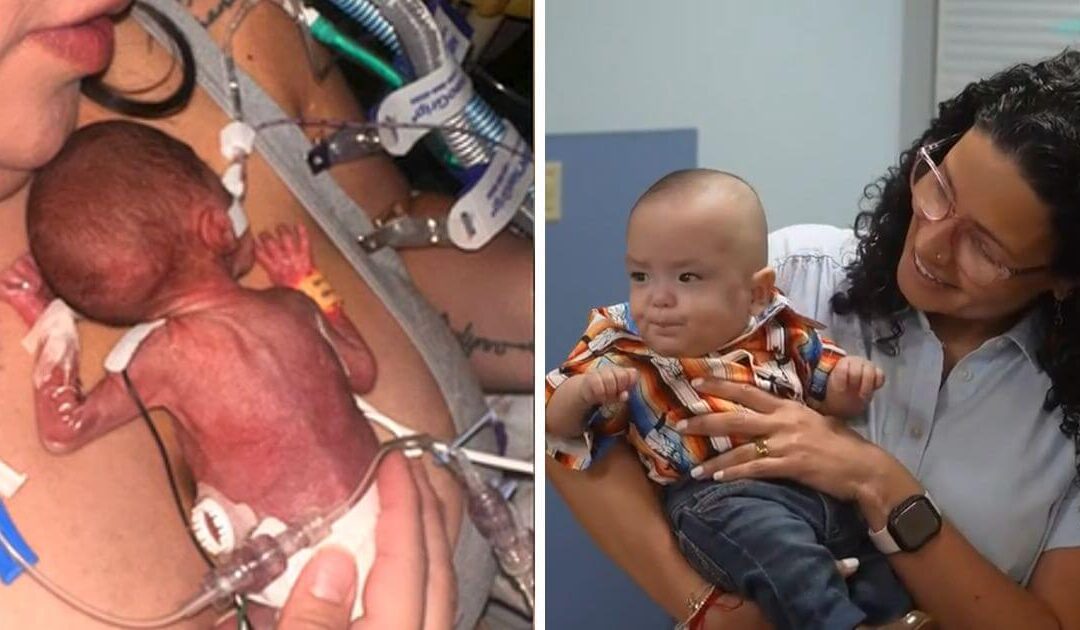 Extremely premature baby born over four months early now thriving at home