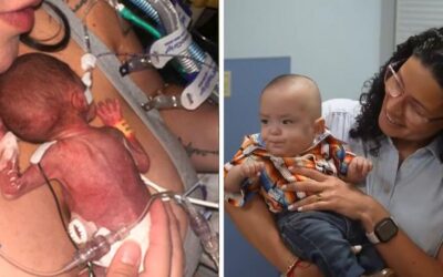 Extremely premature baby born over four months early now thriving at home
