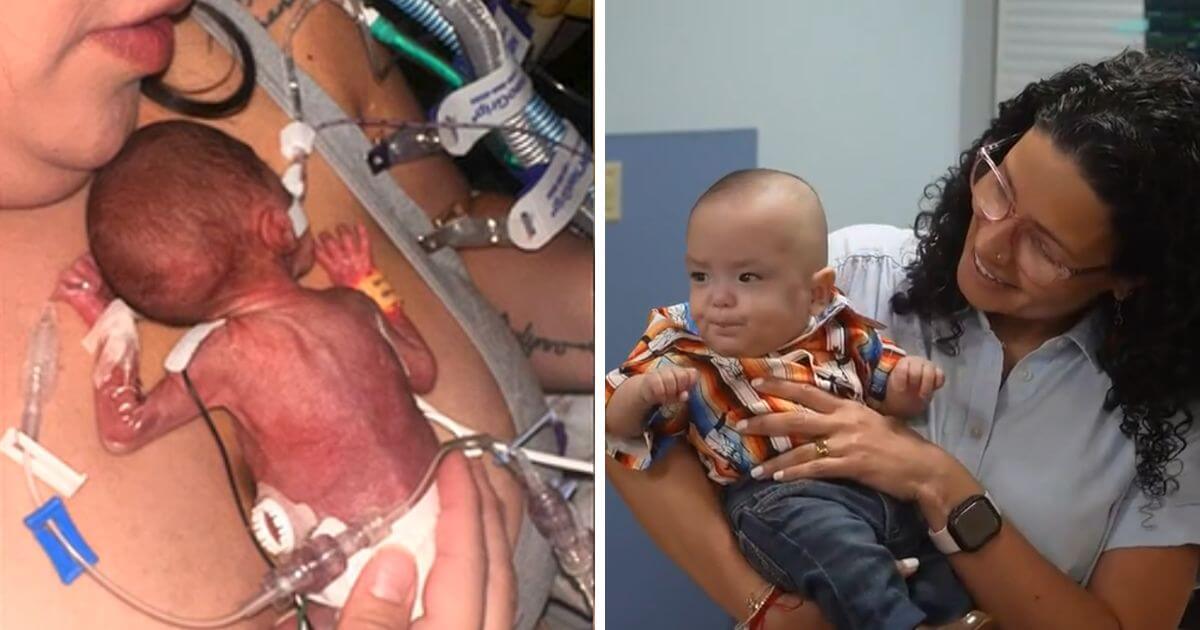 Extremely premature baby born over four months early now thriving at home Extremely premature baby born over four months early now thriving at home