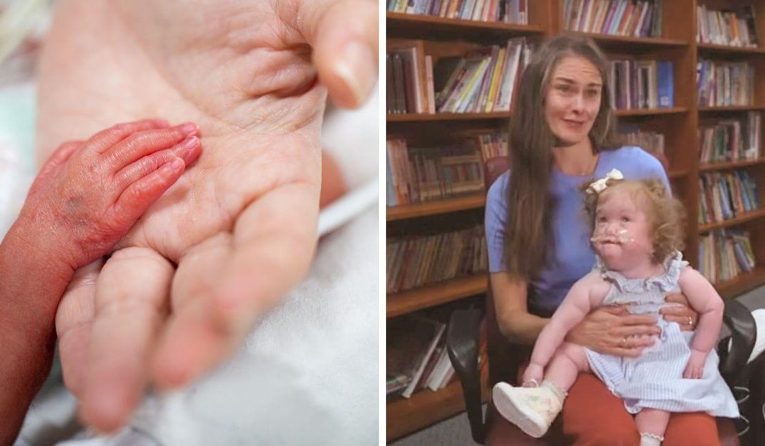 Premature baby born at just 25 weeks, weighing just over 1lb, reunites with hospital team who cared for her