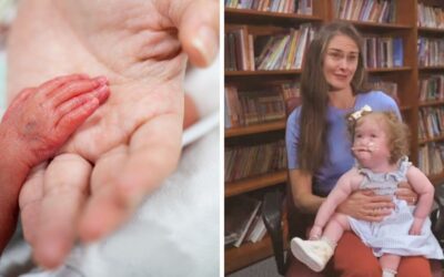 Premature baby born at just 25 weeks, weighing just over 1lb, reunites with hospital team who cared for her